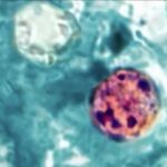 This microscopic image shows Cyclospora cayetanensis oocysts (the parasite that causes the diarrheal illness cyclosporiasis) in a stool sample, stained with safranin. Source: Melanie Moser / CDC